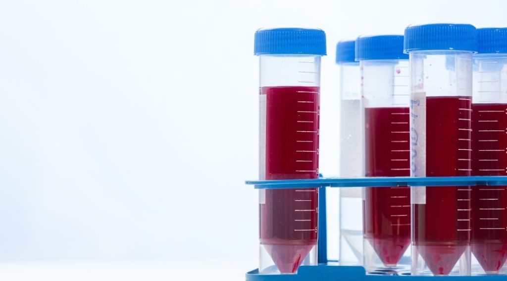 Cuidadosintensivos-hospitalizacion