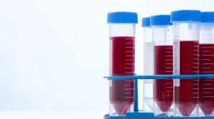 Cuidadosintensivos-hospitalizacion