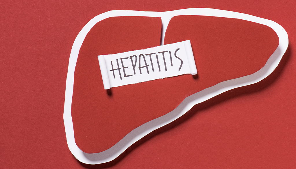 Hepatitis