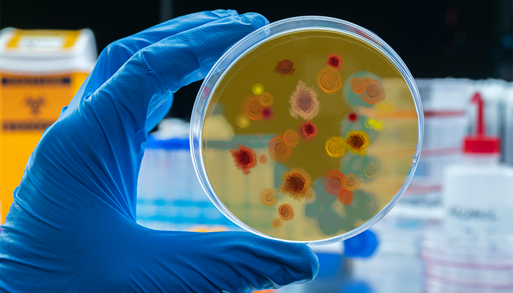 Paludismo o Malaria