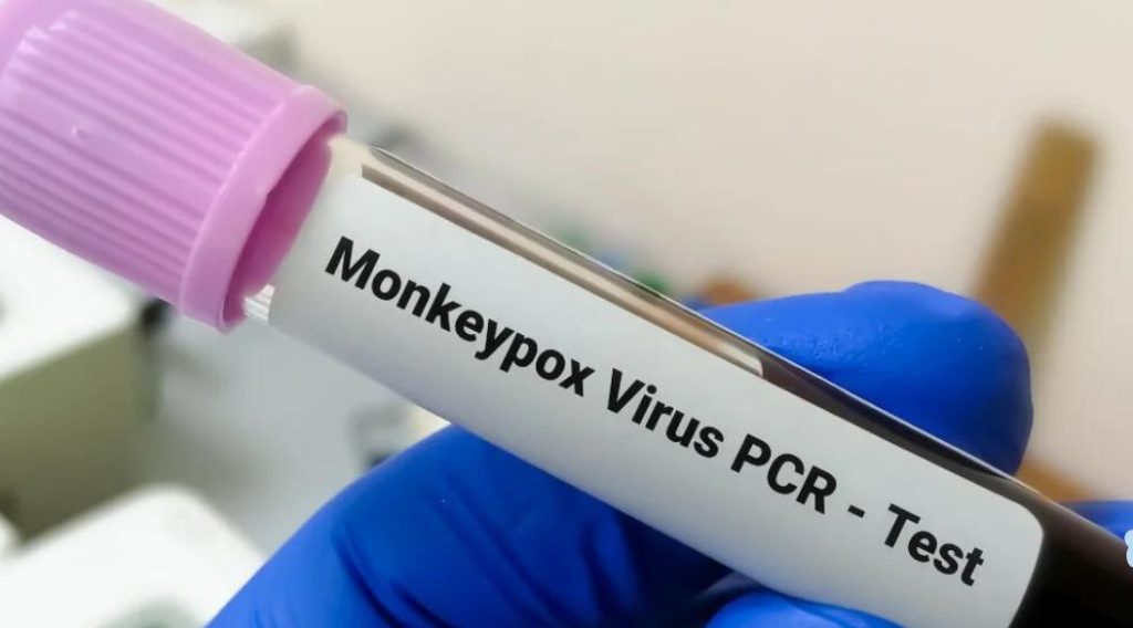 vacuna para viruela del mono o monkeypox