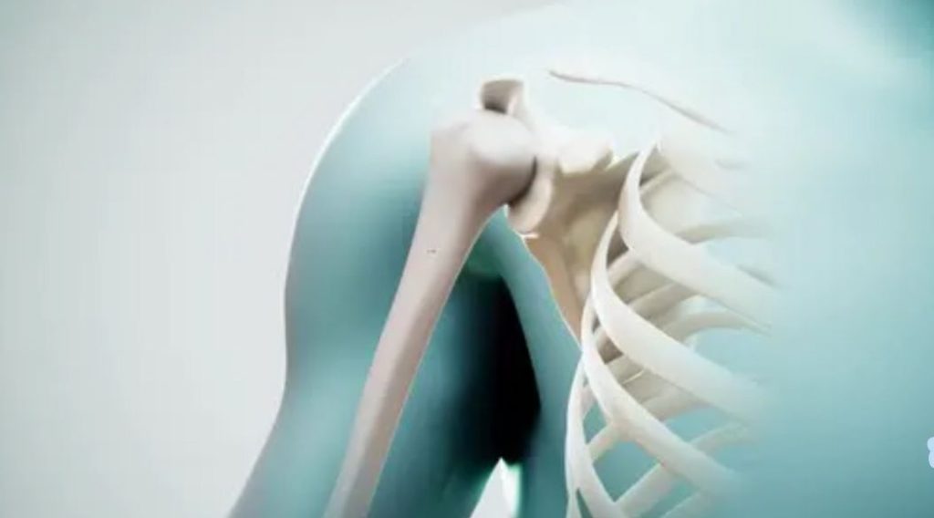 Osteoporosis