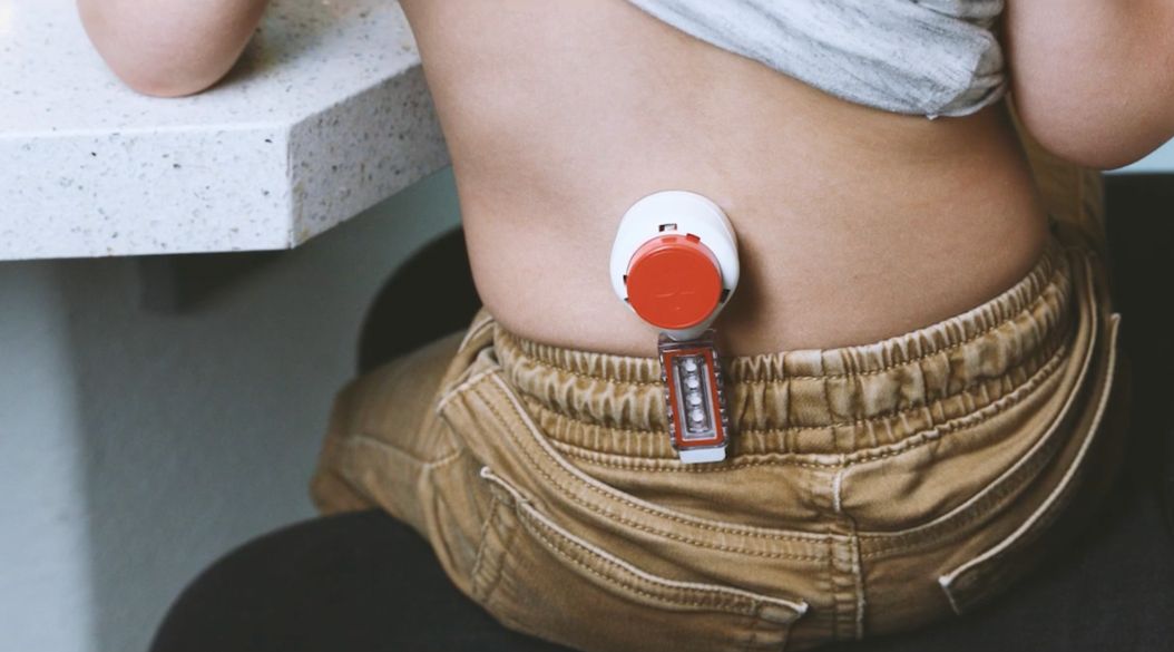 extracción de sangre en ninos- tasso