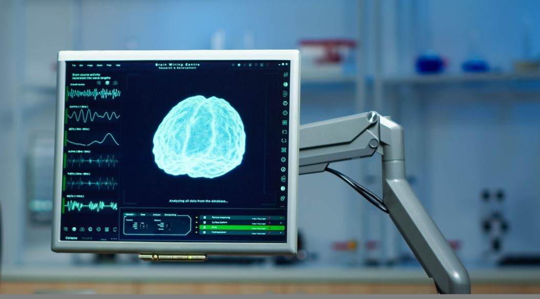 cerebro-ictus-neurologia